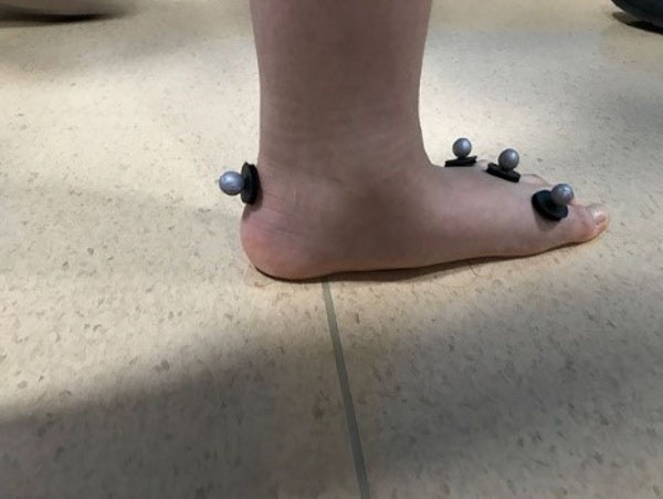 motion capture markers pasted on the feet