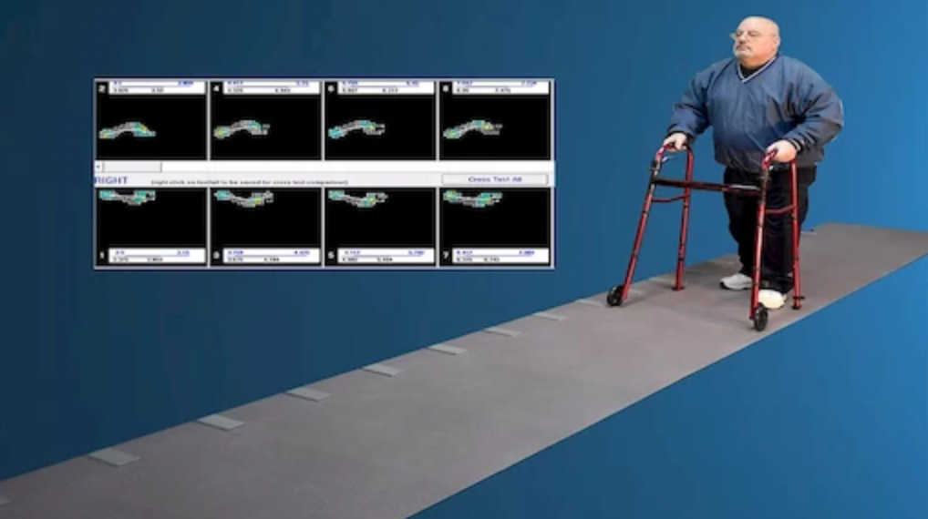 GAITRite Plantar Pressure Measurement